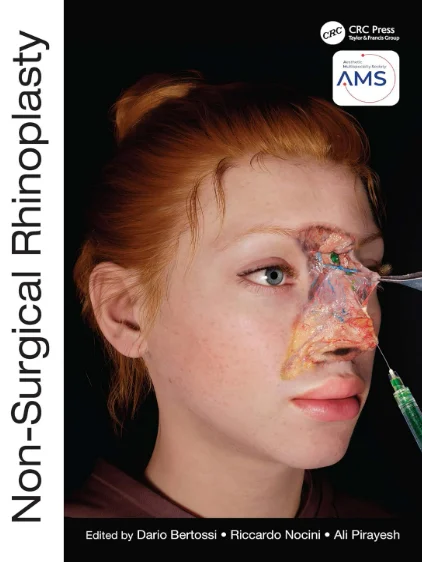 Non-Surgical Rhinoplasty