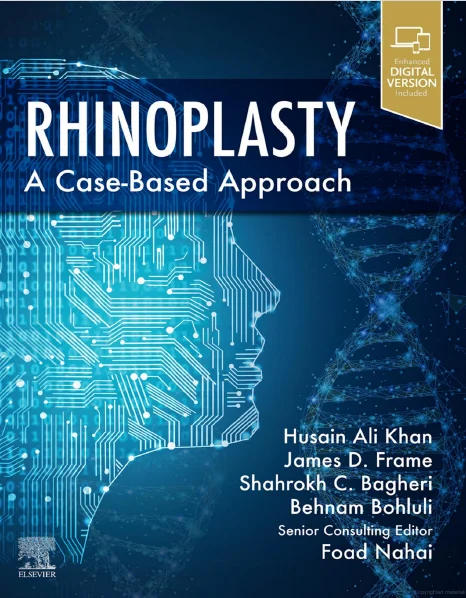 Rhinoplasty A Case-Based Approach