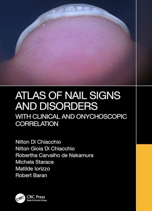 Atlas of Nail Signs and Disorders