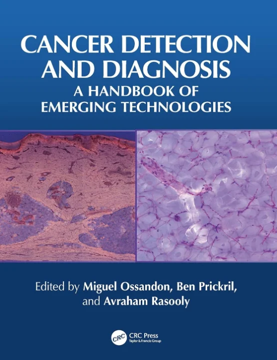 Cancer Detection and Diagnosis A Handbook of Emerging Technologies