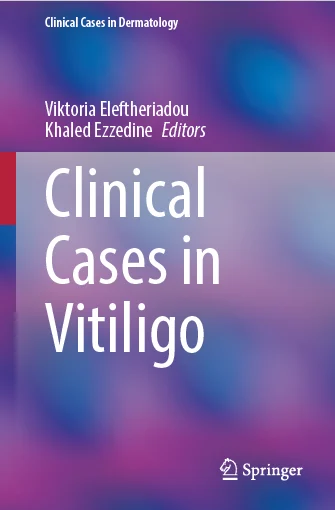 Clinical Cases in Vitiligo
