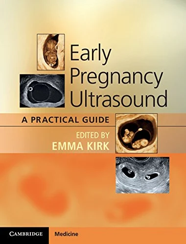 Early Pregnancy Ultrasound