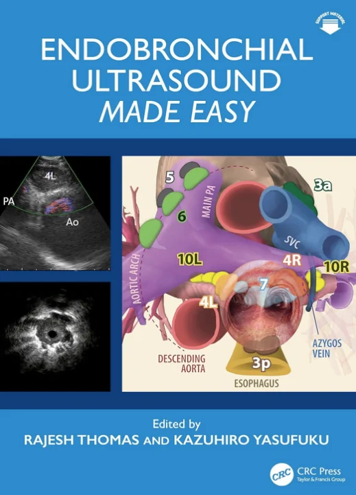 Endobronchial Ultrasound Made Easy