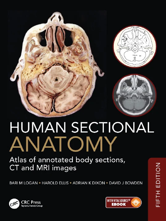 Human Sectional Anatomy: Atlas of Annotated Body Sections, CT and MRI Images  Fifth Edition