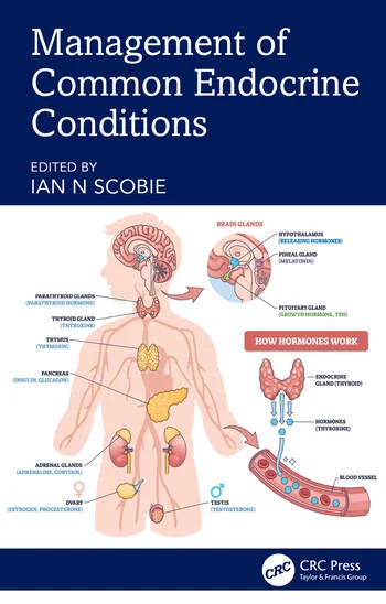 Management of Common Endocrine Conditions