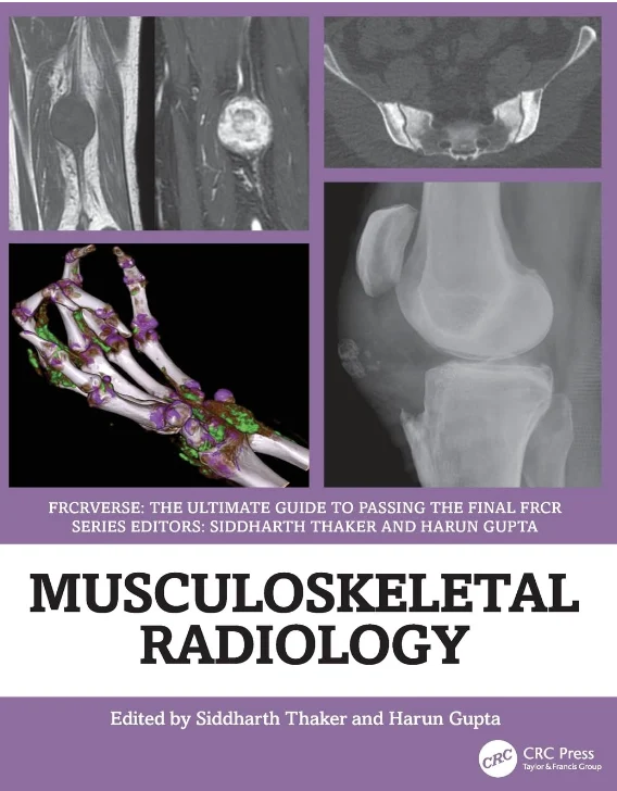 Musculoskeletal Radiology The Ultimate Guide to Passing the Final FRCR