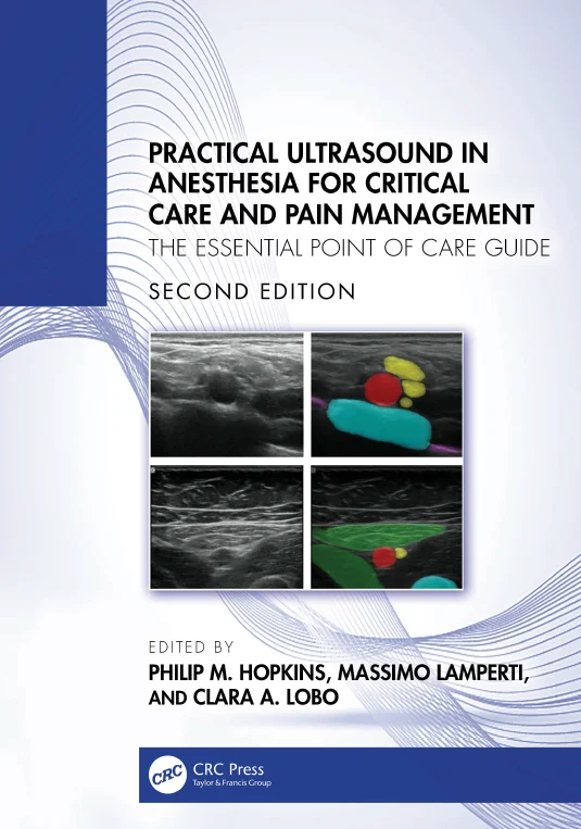 Practical Ultrasound in Anesthesia for Critical Care and Pain Management The Essential Point of Care Guide Second Edition
