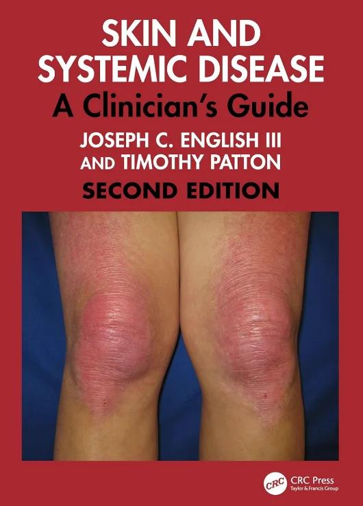 Skin and Systemic Disease A Clinician’s Guide